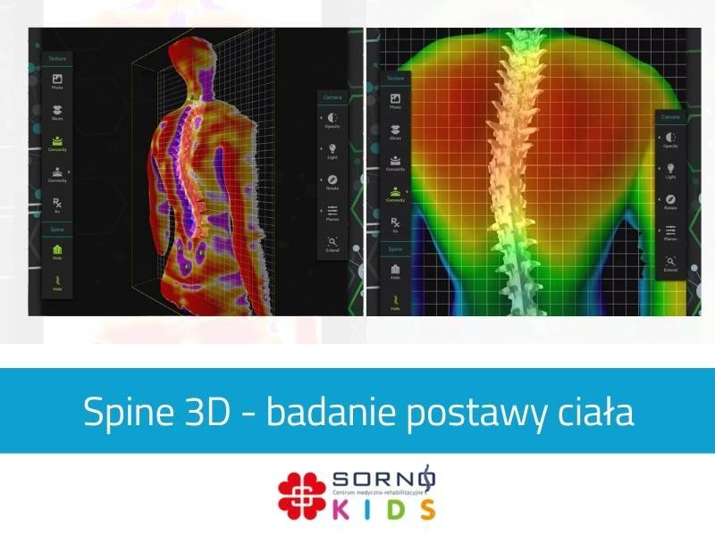 Spine 3D - badanie postawy ciała